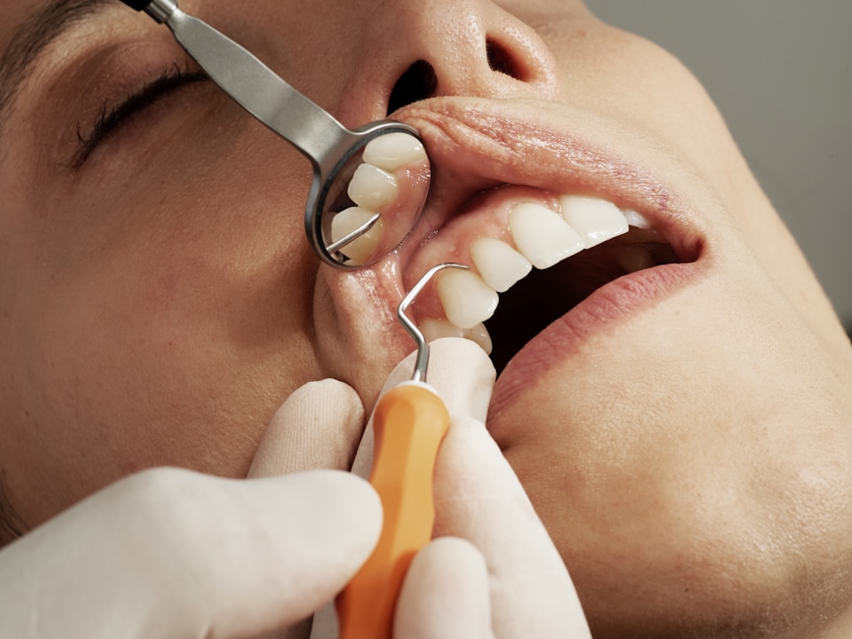 Precizní dentální hygiena Cheb